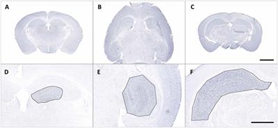 Classification of Microglial Morphological Phenotypes Using Machine Learning